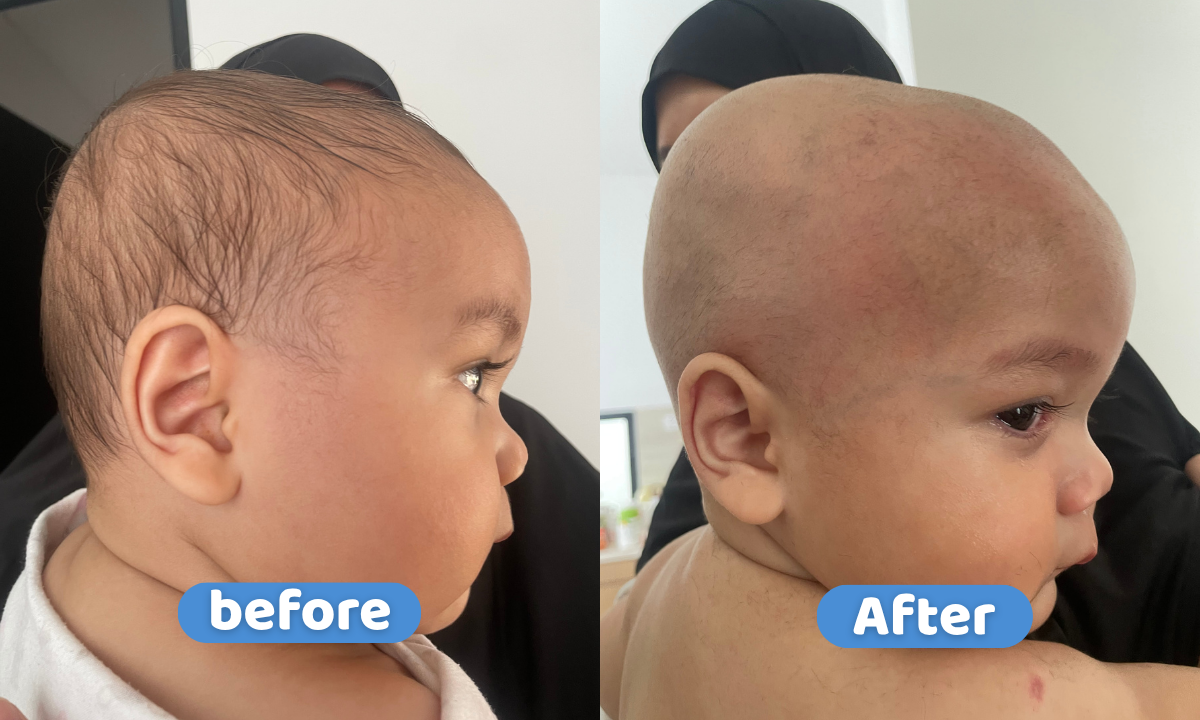 Cukur Rambut kids ( 1-3 tahun )