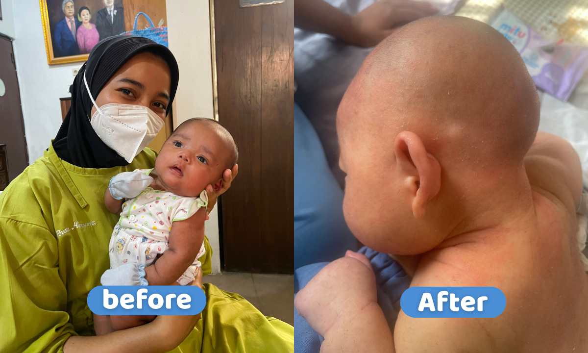 cukur baby tanpa treatment