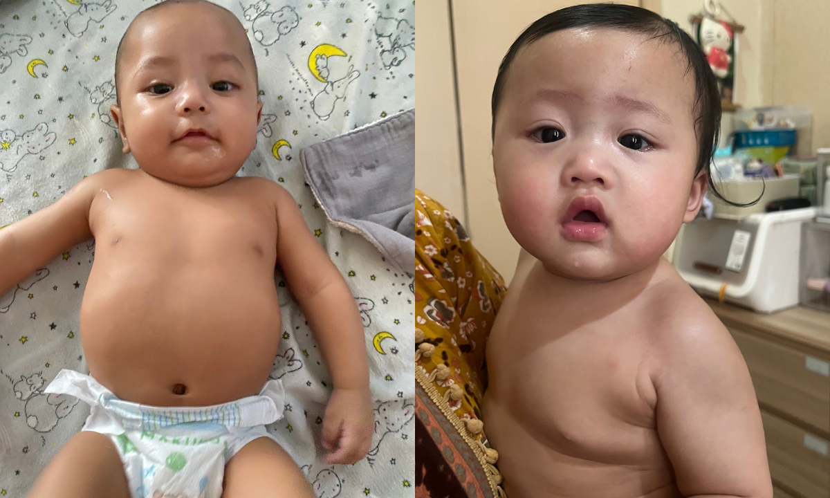 Massage Baby Pediatric